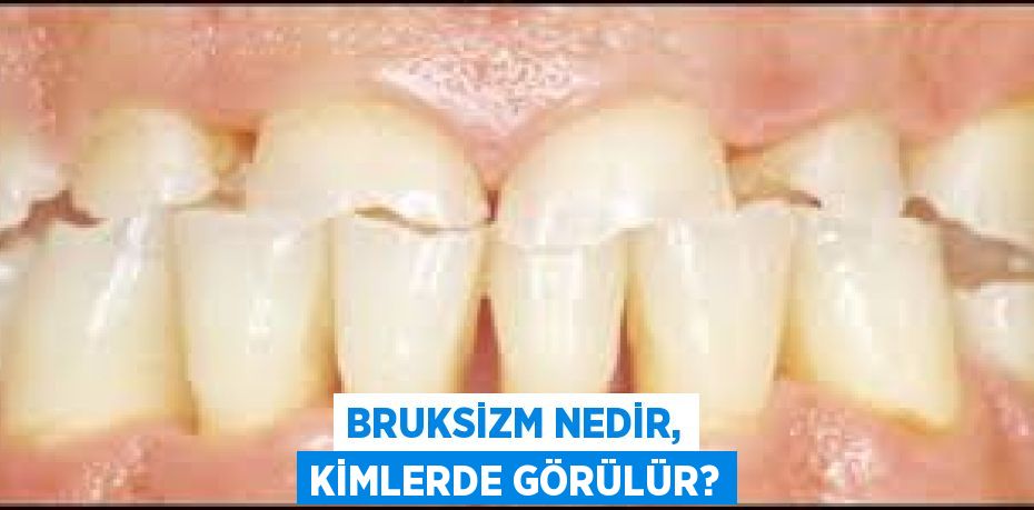 Bruksizm nedir, kimlerde görülür?