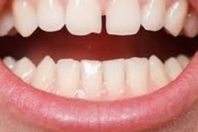 22793286043187522898