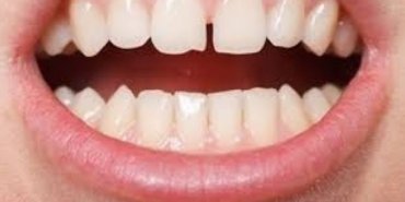 22793286043187522898