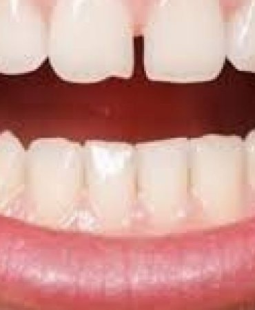 22793286043187522898