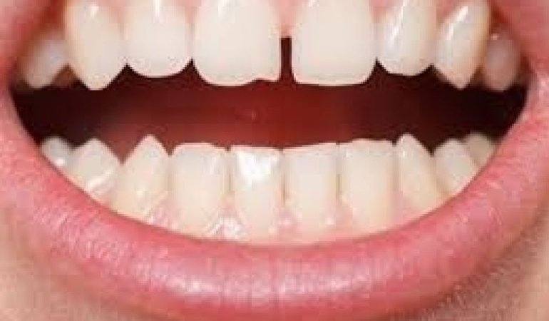 22793286043187522898