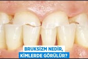 Bruksizm nedir, kimlerde görülür?