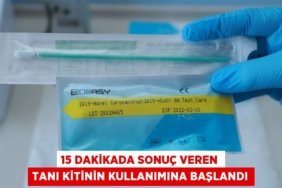 15 dakikada sonuç veren tanı kitinin kullanımına başlandı